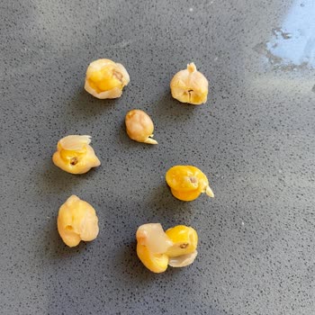 Migros'tan Alınan Bakliyatta Böcek Sorunu Ve Müşteri Hizmetlerine Ulaşamama