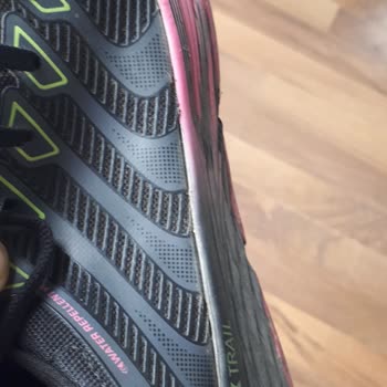 Kısa Sürede Deforme Olan Ayakkabı Ve Mağduriyet