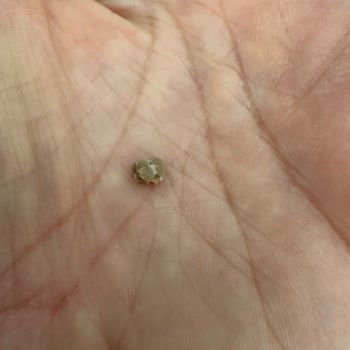 Aldığım Pirincin İçinden Yabancı Madde Çıktı, Sağlığımız Tehlikede