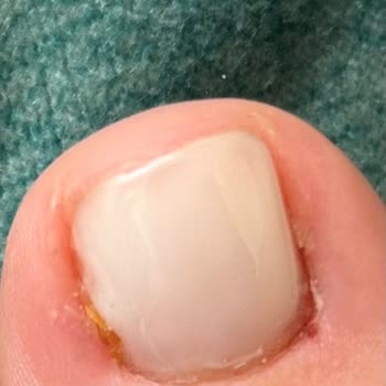 Hijyen Eksikliği Ve Uzman Yetersizliği Nedeniyle Yaşanan Mağduriyet