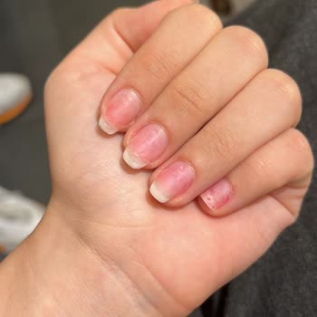 Hijyen Eksikliği Ve Uzman Yetersizliği Nedeniyle Yaşanan Mağduriyet