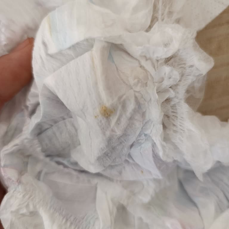 Bebek Bezinden Çıkan Tahta Parçası Ve Yırtık Bez Şoku