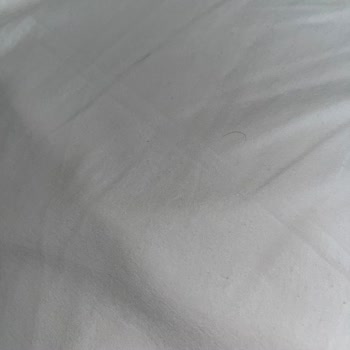 Gold Kaya Otel Çarşaflar Temizlenmemiş