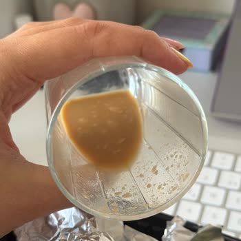 Bozuk Laktozsuz Latte Nedeniyle Sağlık Sorunu Yaşadım