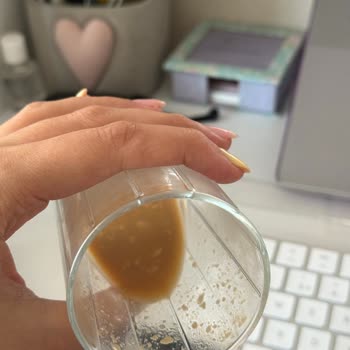 Bozuk Laktozsuz Latte Nedeniyle Sağlık Sorunu Yaşadım