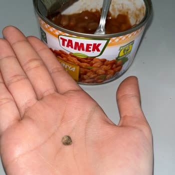 Konserve Barbunyadan Çıkan Taş Dişimi Kırıyordu