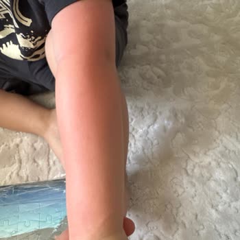 Sebamed Sunscreen Failed to Protect My 3-Year-Old Despite Multiple Reapplications