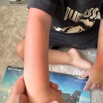 Sebamed Sunscreen Failed to Protect My 3-Year-Old Despite Multiple Reapplications