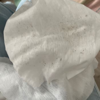 Aldığım Sleepy Islak Mendillerde Küf Ve Koku Sorunu Yaşadım