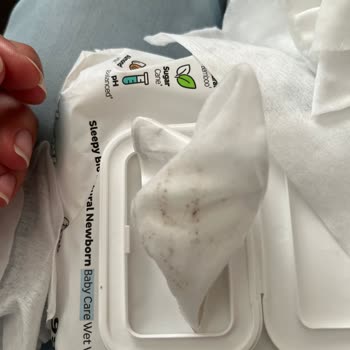 Aldığım Sleepy Islak Mendillerde Küf Ve Koku Sorunu Yaşadım