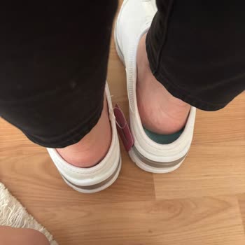 Skechers Terlik Değişim Sürecindeki Zorluklar Hayal Kırıklığı Yarattı