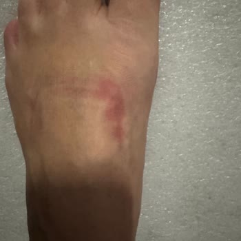 Puma Ayakkabıda Ezilme Sorunu Ve İnceleme Sonuçsuzluğu