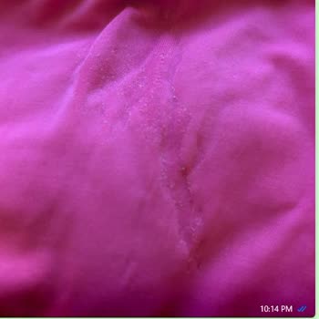 3 Kere Giyilen Bikini Eriyor, Kalite Hayal Kırıklığı!