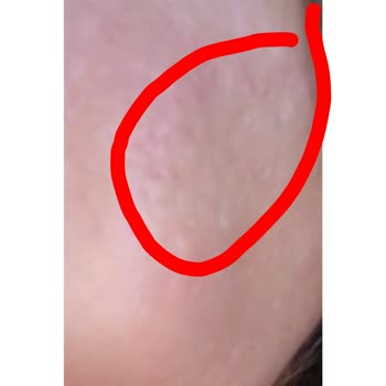 Hayal Kırıklığı Ve Boşa Giden Yüksek Maliyetli Güzellik Deneyimi