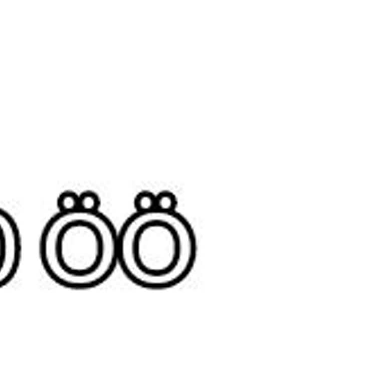 Hesaba Yatırılan Para Görünmüyor, Yardımcı Olacak Var Mı