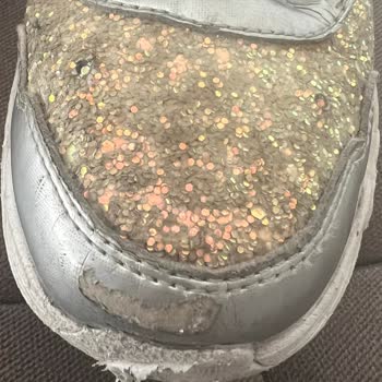 Skechers Ayakkabılarının Hızlı Deformasyonu Ve Müşteri Hizmetleri Sorunu