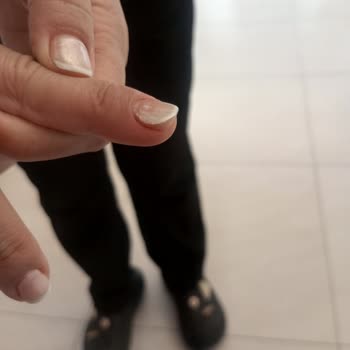 Kalıcı Oje 10 Günde Çıktı Yenileme Yapılmadı