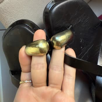 İade Talebim Reddedildi Sandaletin Yüzüğü Kararmış Geldi