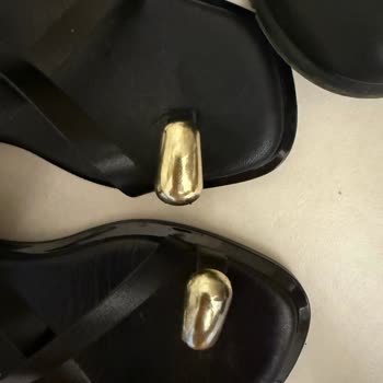 İade Talebim Reddedildi Sandaletin Yüzüğü Kararmış Geldi