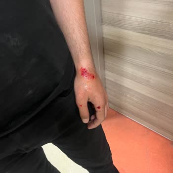 Hastanede İlgisizlik Ve Temizlik Sorunları Nedeniyle Mağduriyet Yaşadık