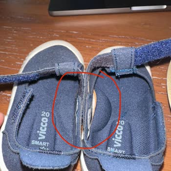 Vicco Bebek Sandaletinde Üretim Hatası Ve İlgisiz Müşteri Hizmeti