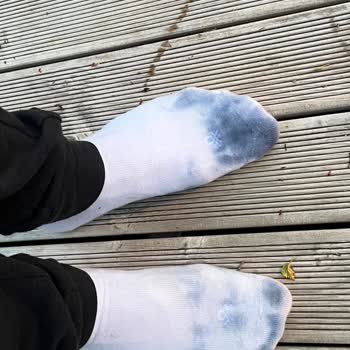 Gant Ayakkabıda Renk Solması Ve Deformasyon Hayal Kırıklığı Yarattı