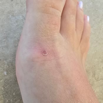 Skechers Terlikler Ayağımı Vurdu İade Edemiyorum