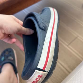 Crocs Terliğim Kısa Sürede Bozuldu, Migros Ve Crocs Sorumluluk Almadı