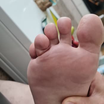 Kocaeli Şehir Hastanesi Ayağımı Mahvetti