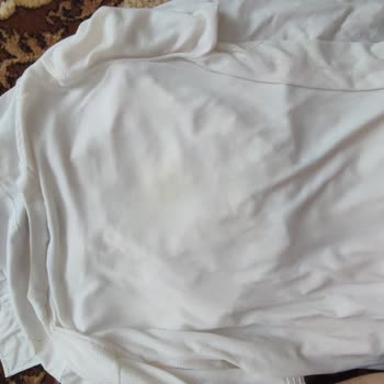 Vanish Kosla Leke Çıkarıcı Ürün Beyaz Tişörtümde Sarı Leke Bıraktı