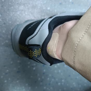 Aldığım Dockers Ayakkabı Her İki Ayağımı Vuruyor, Çözüm Bekliyorum