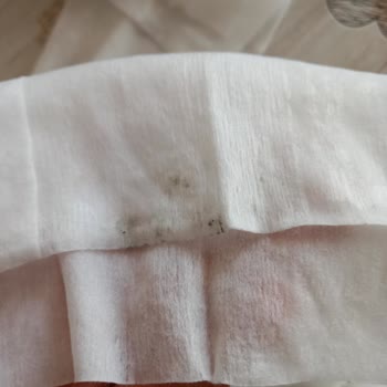 Sleepy Islak Mendilde Küf Sorunu Ve Sağlık Riski