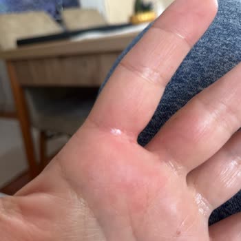 Aldığım Ürün Bir Gün İçinde Arızalandı Ve Elimi Yaktı