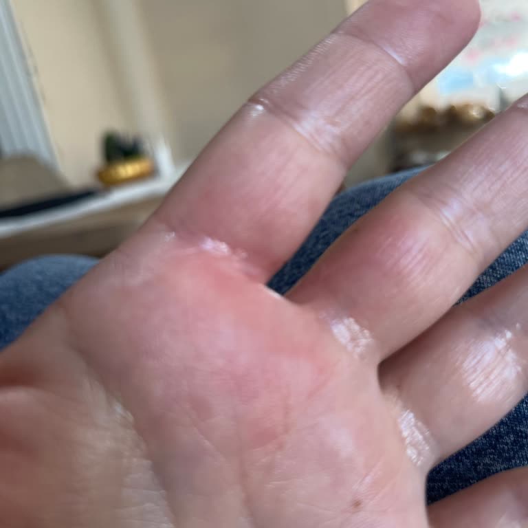 Aldığım Ürün Bir Gün İçinde Arızalandı Ve Elimi Yaktı