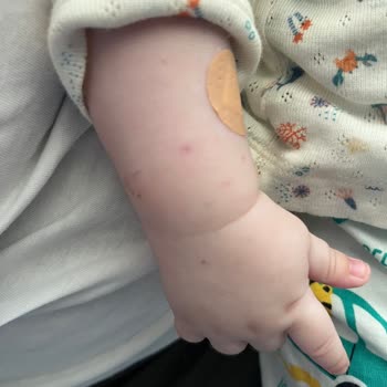 Bebeğimin Ameliyatında Uygunsuz Damar Yolu Denemeleri