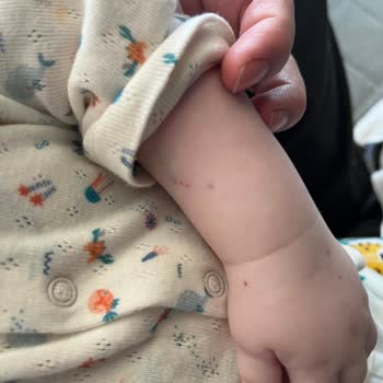 Bebeğimin Ameliyatında Uygunsuz Damar Yolu Denemeleri