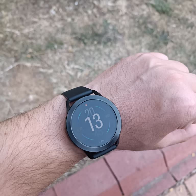 Saatin Çerçevesi Kısa Sürede Bozuldu Ve Servis Çözüm Sunmadı