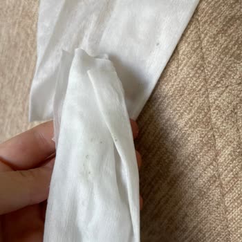 Sleepy Newborn Bebek Bezinde Küf Sorunu Ve Güven Kaybı Yaşadım
