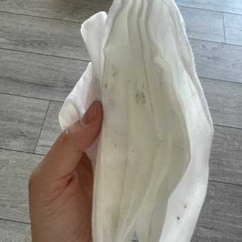 Sleepy Newborn Bebek Bezinde Küf Sorunu Ve Güven Kaybı Yaşadım