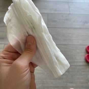 Sleepy Newborn Bebek Bezinde Küf Sorunu Ve Güven Kaybı Yaşadım