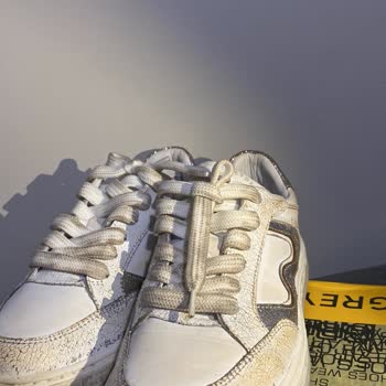 Garanti Kapsamında Renk Değişen Ayakkabı İçin Ücret İadesi Talebim Reddedildi