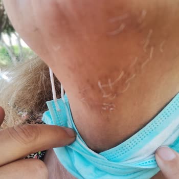 Suit Plus Güzellik Merkezi'nde Mağduriyet Ve İlgisizlik