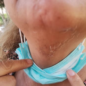 Suit Plus Güzellik Merkezi'nde Mağduriyet Ve İlgisizlik