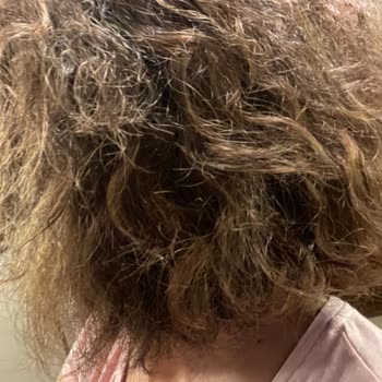 Mehmet Can Akbaş Kuaförde Yaşadığım Kötü Deneyim Ve Mağduriyet