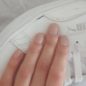 Yeni Alınan Puma Ayakkabıda Açılma Ve Uzun İnceleme Süreci Mağduriyeti