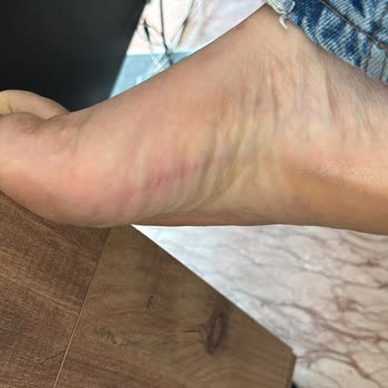 Aldığım Terlik Ayaklarımı Mahvetti, Pişman Oldum