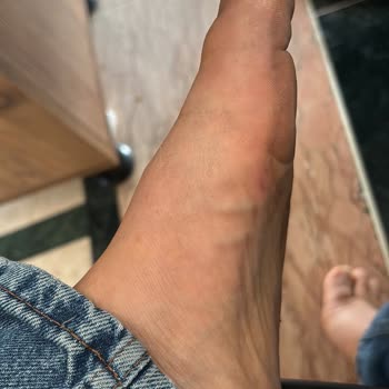 Aldığım Terlik Ayaklarımı Mahvetti, Pişman Oldum