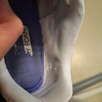 Skechers Ayakkabılar 2 Ayda Deforme Oldu, Değişim Talep Ediyorum