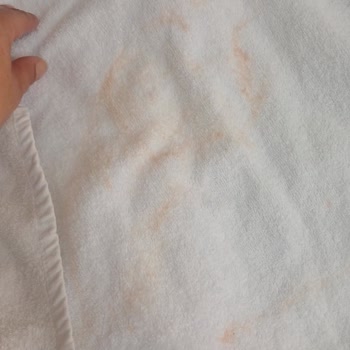 Kurutma Makinelerinde Erken Paslanma Ve Servis Sıkıntısı