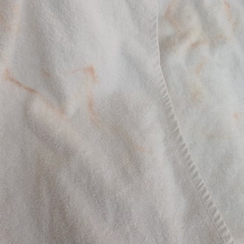 Kurutma Makinelerinde Erken Paslanma Ve Servis Sıkıntısı